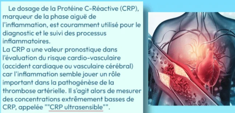 CRP Ultra Sensible