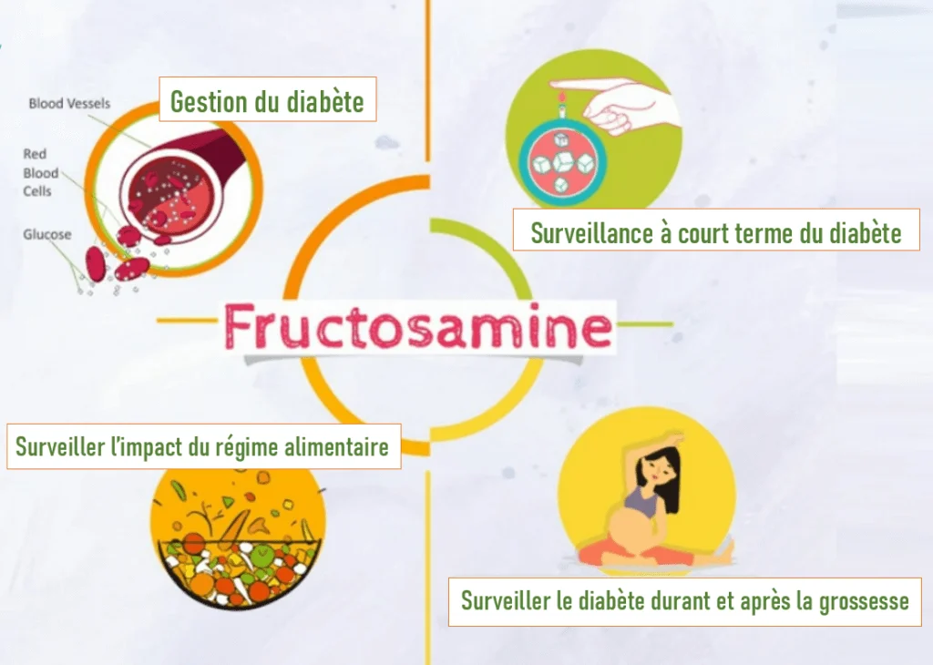 Fructosamine