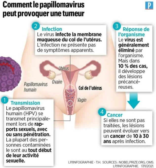 Cancer du col de l'utérus